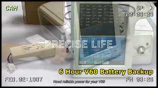 Respironics V60 인공호흡기 배터리 6시간 런타임